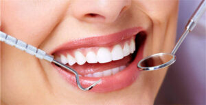 Periodontal Disease Prevention