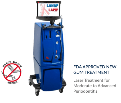 Laser Gum Treatment - LANAP & LAPIP